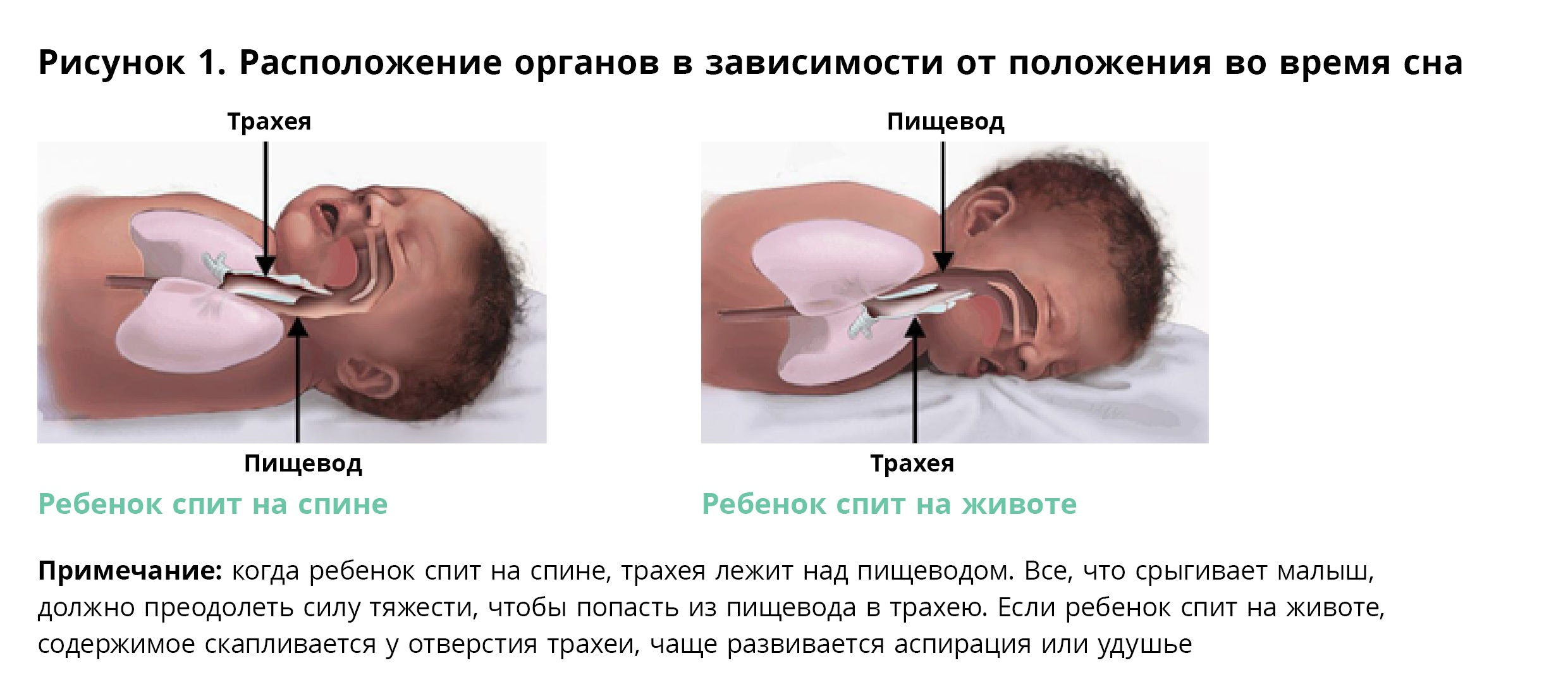 Почему новорожденному нельзя спать. Ребенок потеет во сне причины. Ребенок сильно вспотел во сне причины.